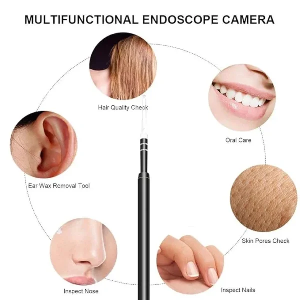 Otoscope