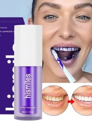 hismile teeth whitening